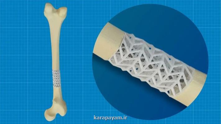 توسعه داربست زیستی برای ترمیم استخوان های شکسته