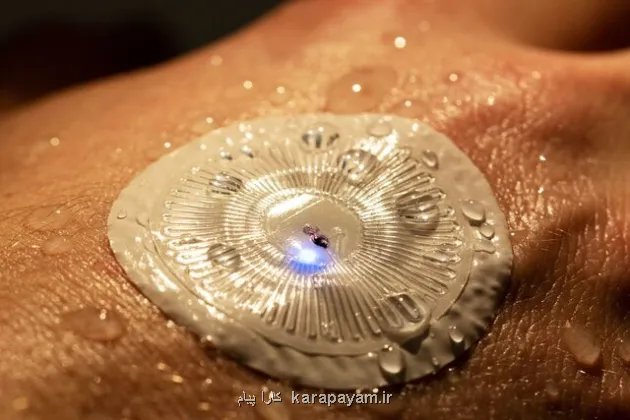 تشخیص آلزایمر و پارکینسون از عرق بدن ممکن می شود!