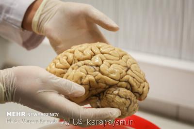 راه اندازی بانك مغز در دانشگاه علوم پزشكی مشهد